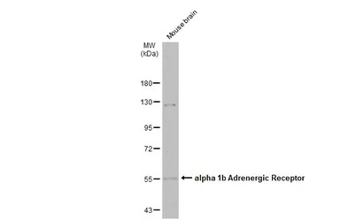 alpha 1b Adrenergic Receptor a