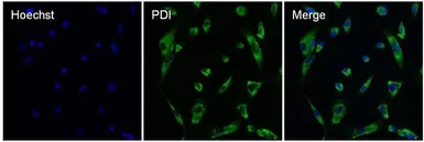 PDI antibody [RL77]