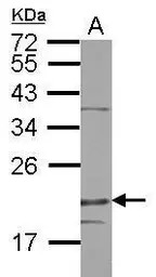 DENR antibody