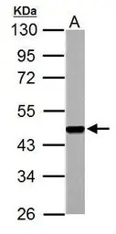 FEN1 antibody