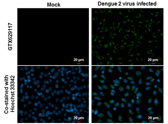 Dengue virus Envelope protein 