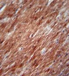 IL2 antibody, Internal