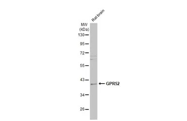 GPR52 antibody