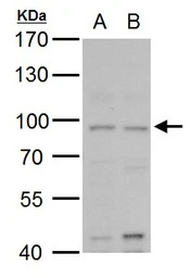 MLH1 antibody