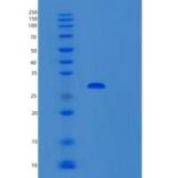 小鼠肿瘤坏死因子SF8/CD30L受体/CD30重组蛋白C-6His