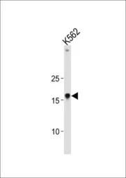 HMGA1 antibody, C-term