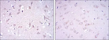 GluR3 antibody [1D2]