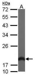 HPCAL1 antibody [N1C3]
