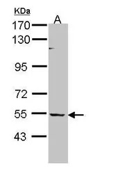 BAIAP2L1 antibody [N1C1]