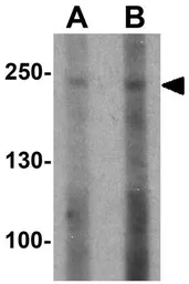 ABCA7 antibody