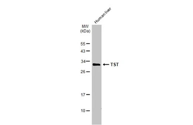 TST antibody
