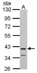 MAB21L1 antibody