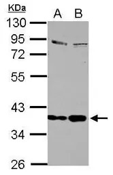 Selenoprotein P antibody
