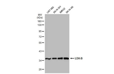 LDH-B antibody