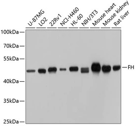 Fumarate hydratase antibody