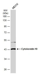 Cytokeratin 19 antibody [N1C1]