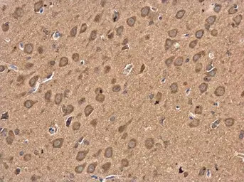 GABA B Receptor 1 antibody [N2