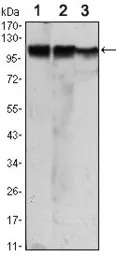 Hexokinase II antibody [3D3]
