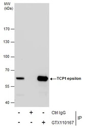 TCP1 epsilon antibody [N1C1]