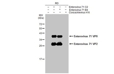 Enterovirus 71 VP2 antibody