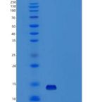 人β-神经生长因子/β-NGF重组蛋白Ser122-Arg239, Cells