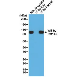 6X His tag antibody [RM146]