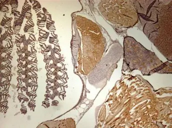 CaMKII delta antibody