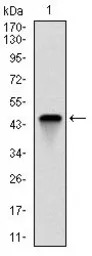 Troponin I fast skeletal muscl
