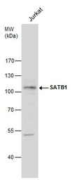 SATB1 antibody