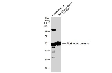 Fibrinogen gamma antibody