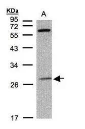 PHOX2B antibody