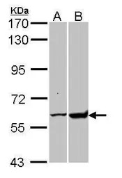 GPI antibody