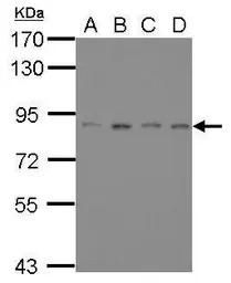 ATRIP antibody [11]