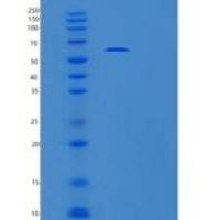 人白细胞介素17受体A重组蛋白