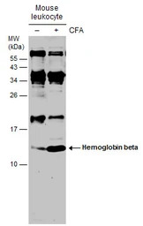 Hemoglobin beta antibody