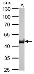 Citrate synthase antibody [GT2