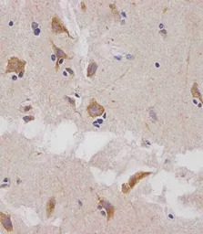 Glutaminase antibody, C-term