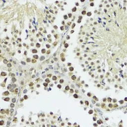 Histone H3T11ph (phospho Thr11