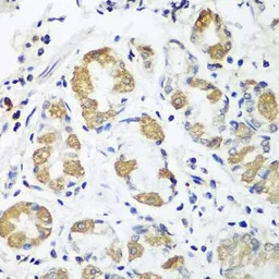 OXCT1 antibody
