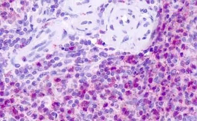 Neurokinin 1 Receptor antibody