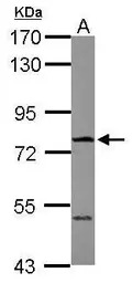 FBXO21 antibody