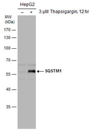 SQSTM1 / P62 antibody