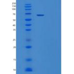 人血清白蛋白/HSA重组蛋白C-8His