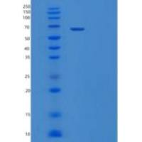 人血清白蛋白/HSA重组蛋白C-8His