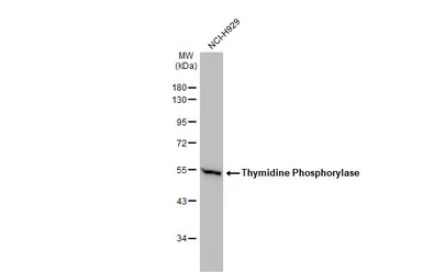 Thymidine Phosphorylase antibo