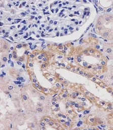 Glutaminase antibody, C-term