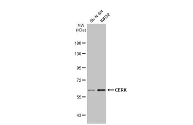 CERK antibody