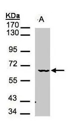 MAK antibody [N1N3]