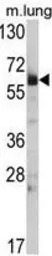 Hsp 60 antibody, N-term