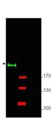 Gli2 antibody